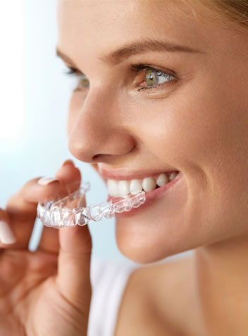 clear aligners